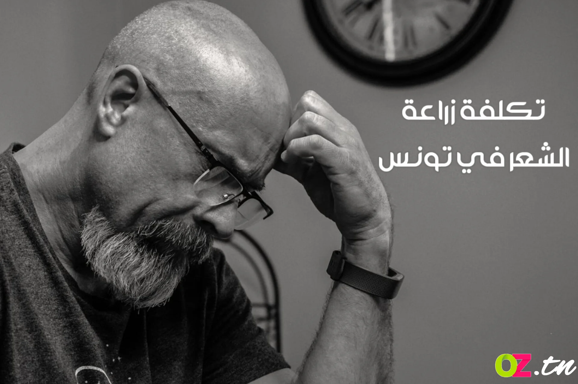 تكلفة زراعة الشعر في تونس بالدينار التونسي