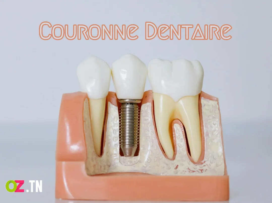 couronne dentaire