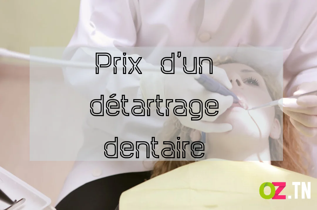 Prix detartrage dentaire
